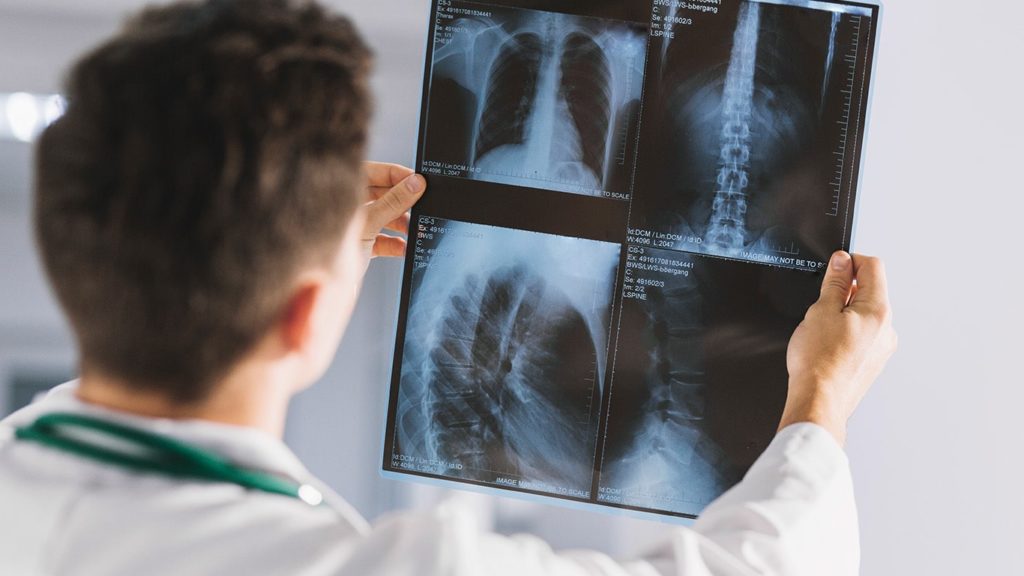 Types of X-rays
