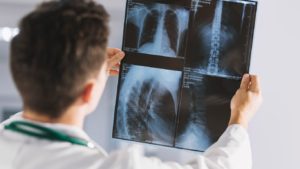Types of X-rays