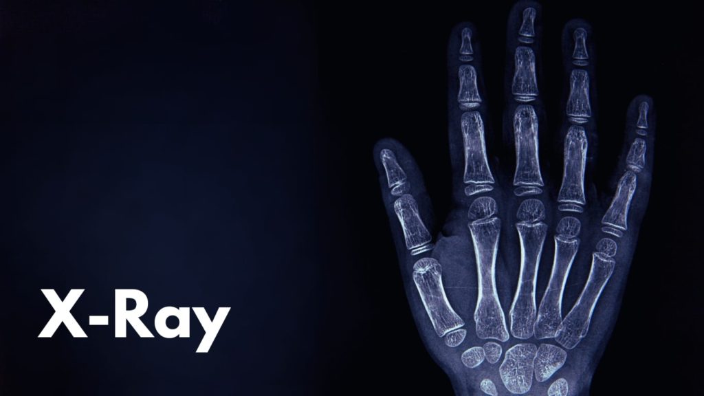 X-Ray
